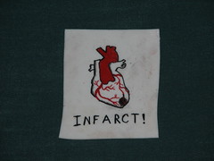 Shrinky-dink: Myocardial infarction